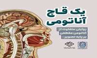 انجمن علمی دانشجویی رادیولوژی کاشان با همکاری معاونت فرهنگی دانشگاه برگزار میکند: وبینار "یک قاچ آناتومی" روایتی متفاوت از آناتومی مقطعی، بر پایه تصویر